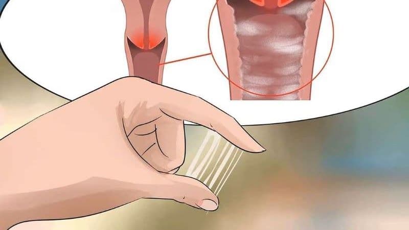 Thăm khám sớm giúp bác sĩ xác định chính xác nguyên nhân gây viêm âm hộ
