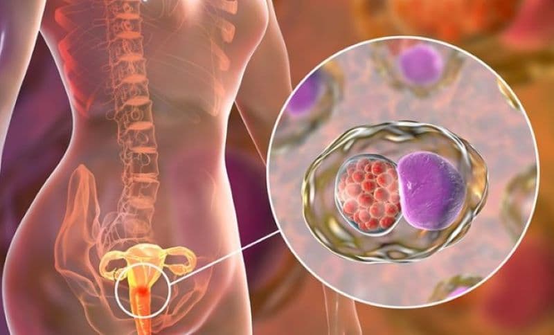 Nhiễm nấm, vi khuẩn hoặc virus là nhóm nguyên nhân phổ biến nhất gây viêm âm hộ