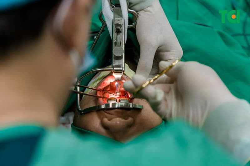 Bác sĩ lựa chọn kỹ thuật dựa trên vị trí tắc nghẽn, mức độ ngưng thở và cấu trúc hầu họng của từng người