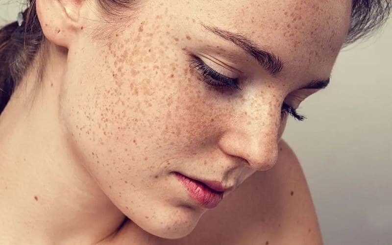 Không nên tự điều trị các bệnh về da, nhất là khi triệu chứng đã kéo dài