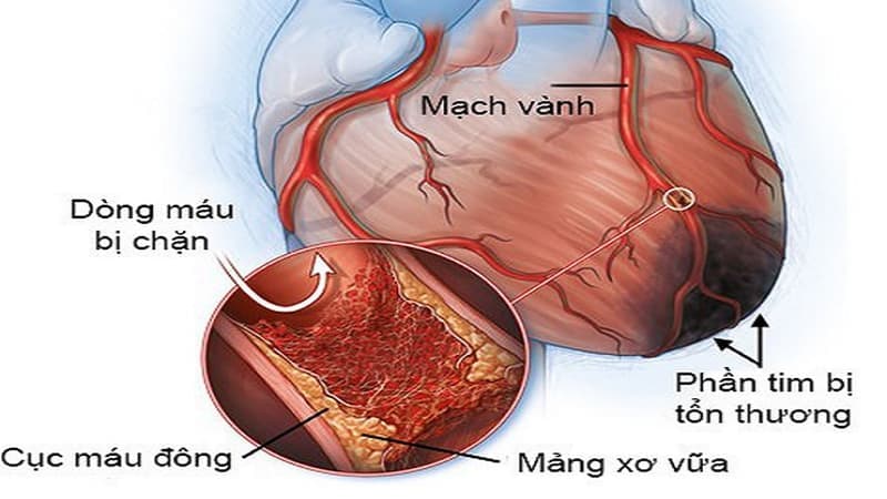 phòng khám tim mạch ở Từ Liêm