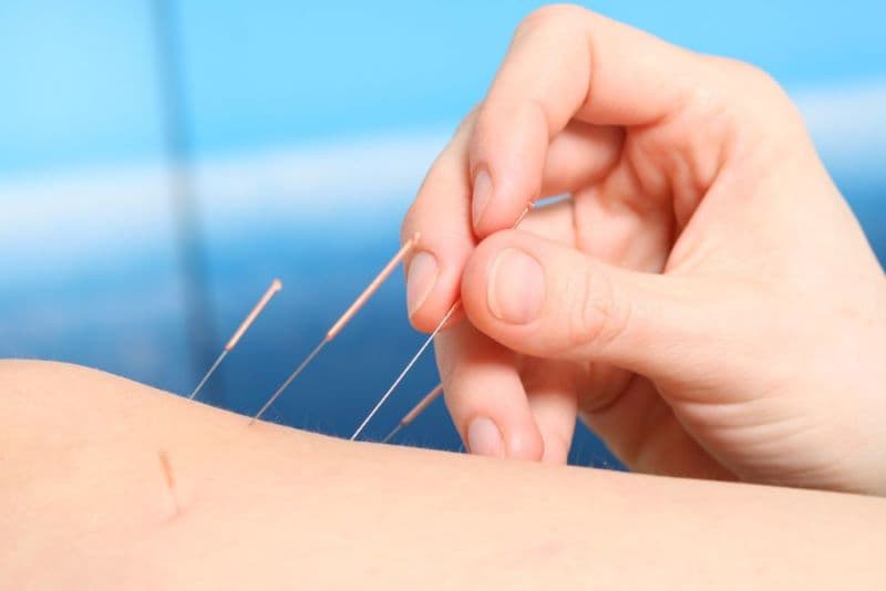 Mai hoa châm sử dụng dụng cụ có nhiều đầu kim nhỏ để gõ hoặc kích thích nhẹ trên bề mặt da