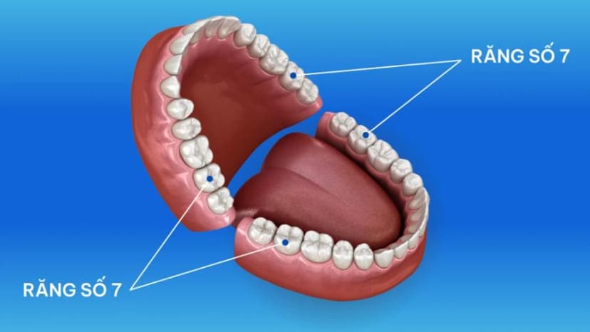 Răng số 7: Chức năng, dấu hiệu hư tổn và giải pháp phục hồi toàn diện