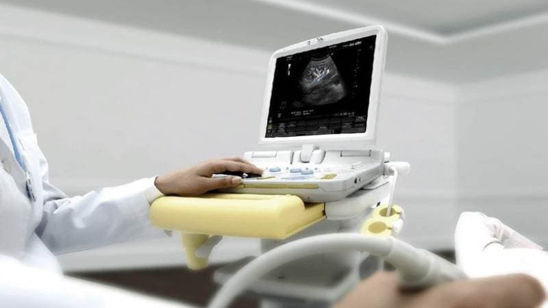 Siêu âm là phương pháp chẩn đoán hình ảnh sử dụng sóng âm để tạo hình ảnh các cơ quan và cấu trúc bên trong cơ thể