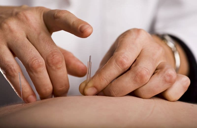 Tác dụng của châm cứu có thể được sử dụng như một liệu pháp bổ trợ trong một số bệnh lý, đặc biệt là đau mạn tính hoặc cơ xương khớp