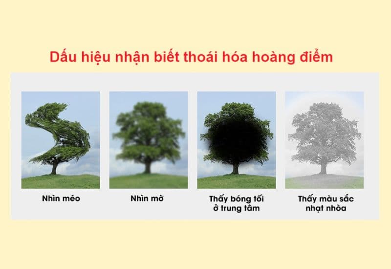 thoái hóa hoàng điểm