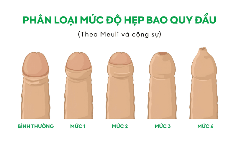 chi phí cắt bao quy đầu bệnh viện