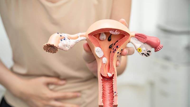 Khả năng khỏi bệnh phụ thuộc vào tác nhân gây viêm, mức độ tổn thương cổ tử cung