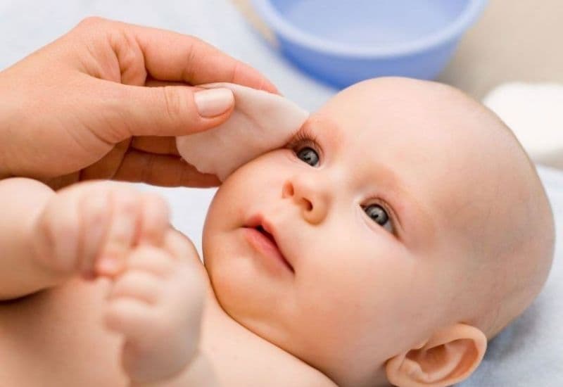Cách vệ sinh mắt chảy ghèn cho trẻ tại nhà