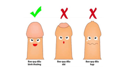 Khám cắt bao quy đầu: Hướng dẫn cụ thể từ A-Z