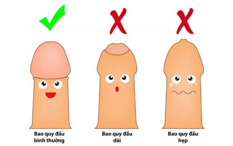Trường hợp nên can thiệp cắt bao quy đầu