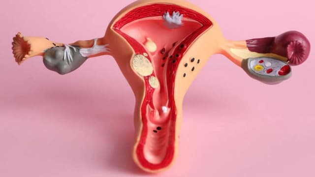 Khám viêm âm hộ ở Tây Hồ: Nguyên nhân, dấu hiệu và cách điều trị