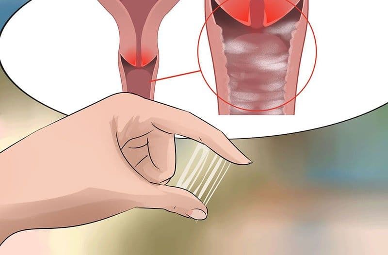 Viêm âm hộ là tình trạng viêm ở vùng sinh dục ngoài của nữ giới