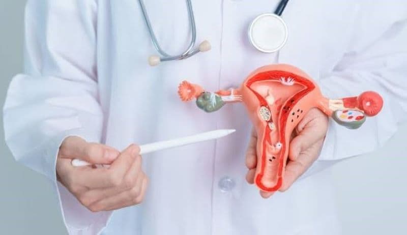 Viêm cổ tử cung không phải lúc nào cũng gây ra triệu chứng rõ ràng