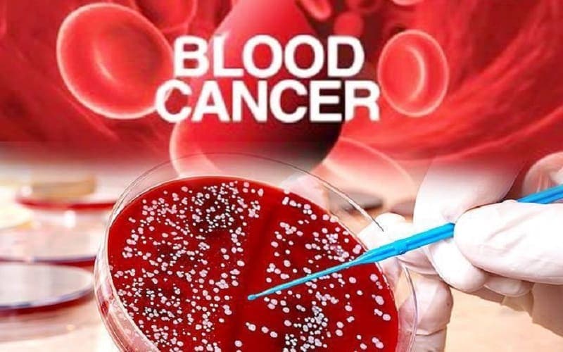Xét nghiệm máu là xét nghiệm chẩn đoán ung thư máu đầu tay giúp chẩn đoán bệnh