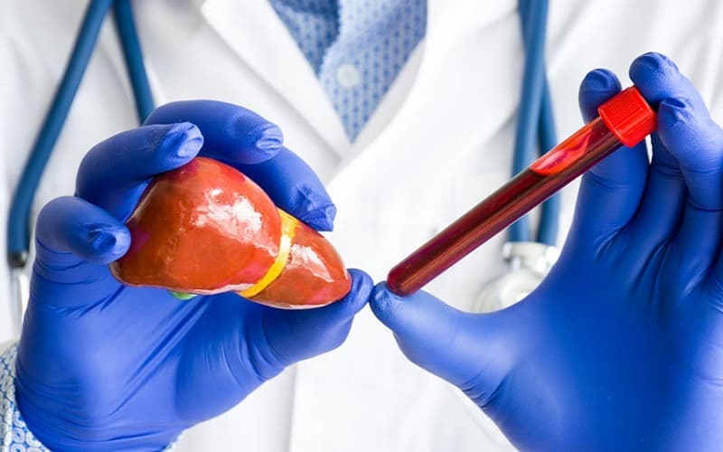 Xét nghiệm máu và chẩn đoán hình ảnh giúp bác sĩ đánh giá chức năng gan mật