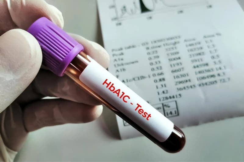 Kỹ thuật xét nghiệm HbA1c giúp phát hiện sớm giai đoạn tiền tiểu đường và chẩn đoán đái tháo đường type 2