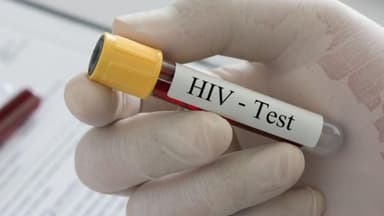 Nên xét nghiệm HIV AIDS ở Hoàng Mai tại đâu uy tín, chính xác và bảo mật thông tin?