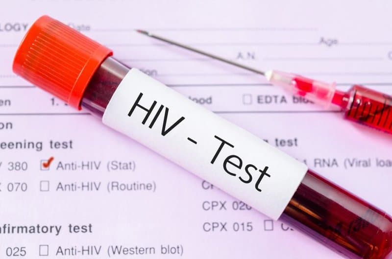 xét nghiệm HIV