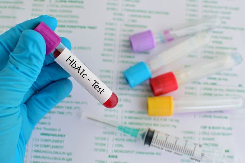 HbA1c là một trong những xét nghiệm đường huyết giúp chẩn đoán tiền đái tháo đường.