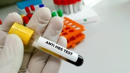 Xét nghiệm Anti HBs dương tính có ý nghĩa gì?