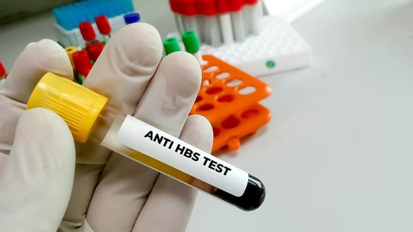 Xét nghiệm Anti HBs dương tính có ý nghĩa gì?