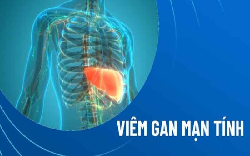 Bàn tay son có thể liên quan đến một số bệnh lý gan mạn tính