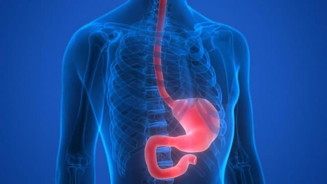 Barrett thực quản có nguy hiểm không? Nguy cơ biến chứng và ung thư thực quản