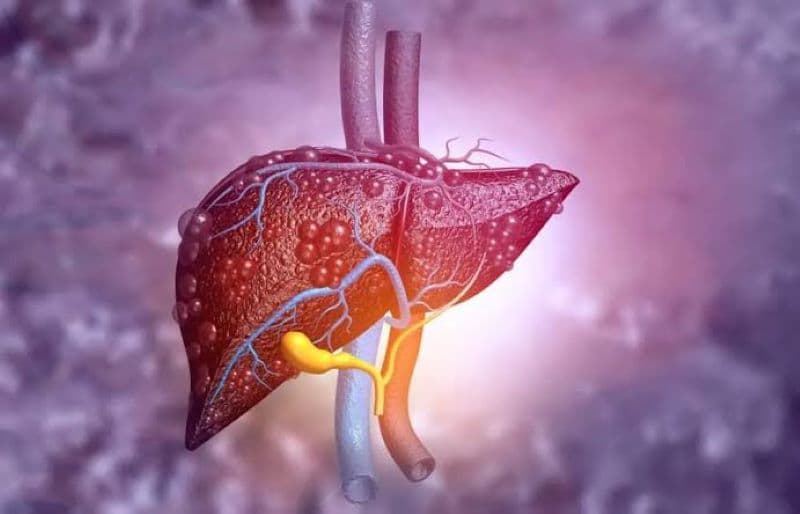 Bệnh gan có lây không còn phụ thuộc vào nguyên nhân gây bệnh