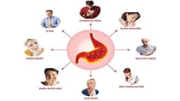 Bị dạ dày gồm những bệnh gì? Các triệu chứng bị dạ dày và cách xử lý