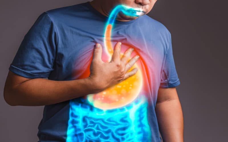 Trào axit dạ dày là hiện tượng dịch tiêu hóa chứa axit từ dạ dày di chuyển ngược lên thực quản