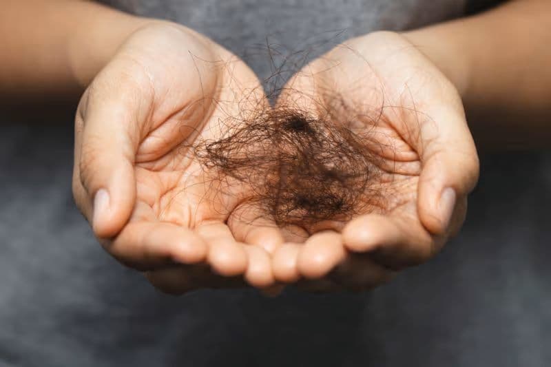 Người bị viêm gan B bị rụng tóc không đồng nghĩa bệnh đang trở nặng