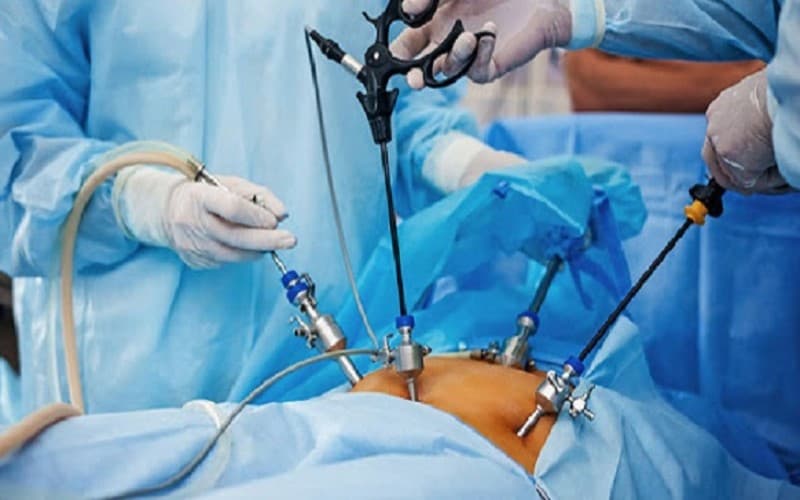 Mổ cắt túi mật nội soi thường ít xâm lấn và có thời gian hồi phục nhanh, nhưng vẫn có thể xảy ra một số biến chứng sau phẫu thuật