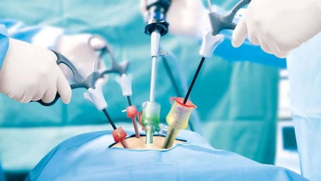 Biến chứng sau mổ ruột thừa nội soi: Dấu hiệu nào cần lưu ý?