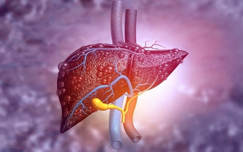 Bilirubin toàn phần tăng có thể là dấu hiệu gợi ý bất thường trong chức năng gan mật