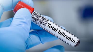 Bilirubin toàn phần là gì? Chỉ số bao nhiêu là cao?