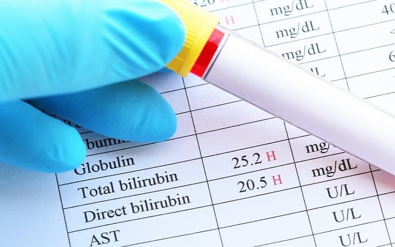 Xét nghiệm bilirubin trực tiếp giúp đánh giá tình trạng chuyển hóa bilirubin