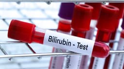 Bilirubin trực tiếp là gì? Chỉ số bao nhiêu là cao?