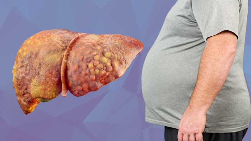 Các bệnh về gan thường gặp: Dấu hiệu, nguyên nhân và cách phòng ngừa