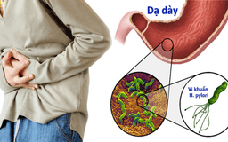 Viêm dạ dày HP là gì? Thông tin chi tiết