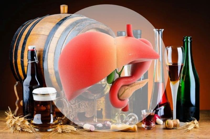 Rượu có thể gây tích tụ mỡ, viêm và tổn thương tế bào gan
