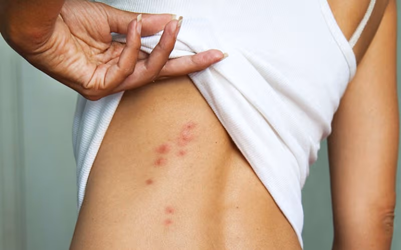 Người bệnh cần đi khám để chẩn đoán sẩn ngứa do gan