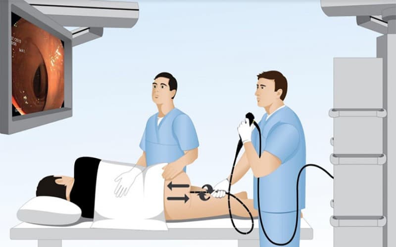 Chẩn đoán và điều trị viêm dạ dày mạn tính như thế nào