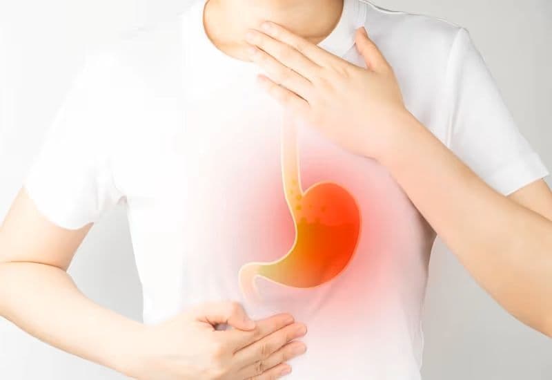 Triệu chứng trào ngược dạ dày thường gặp