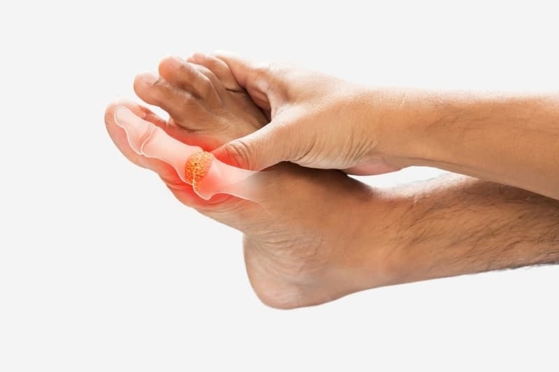 Những trường hợp cơ thể khó hấp thu và chuyển hóa oxalat cần hết sức thận trọng khi ăn cà tím