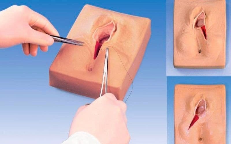Mẹ cần theo dõi vùng tầng sinh môn hằng ngày để phát hiện sớm dấu hiệu vết khâu tầng sinh môn bị hở hoặc nhiễm trùng