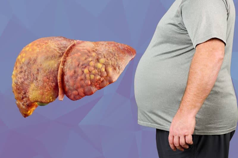Bệnh gan thường diễn tiến âm thầm, nhiều trường hợp không có triệu chứng rõ ràng ở giai đoạn đầu