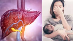 Tình trạng gan nhiễm mỡ sau sinh có nguy hiểm không?