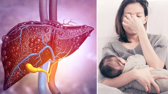 Tình trạng gan nhiễm mỡ sau sinh có nguy hiểm không?