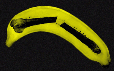 Gãy dương vật có cần phẫu thuật không?